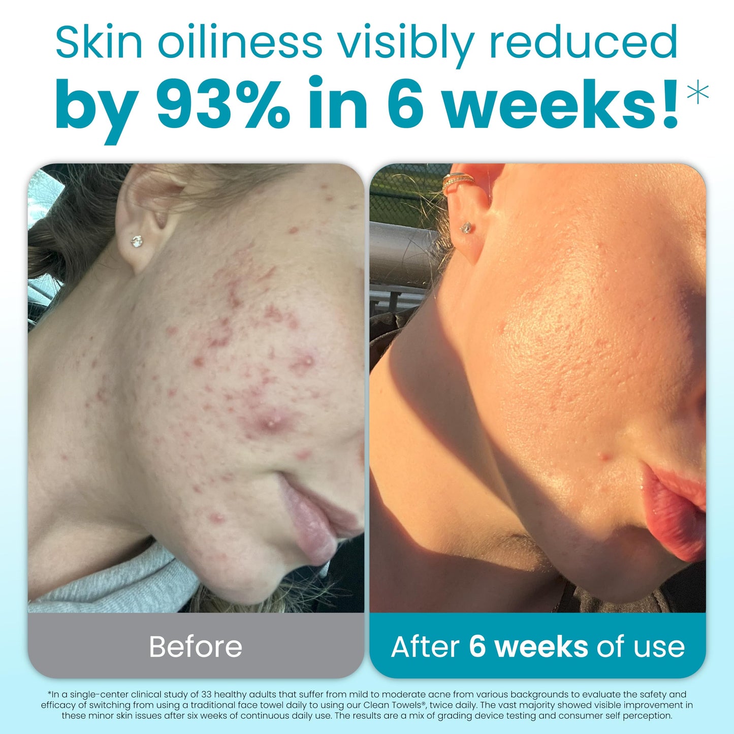 Clean Skin Club Clean Blemish Control Towels XL™, 100% USDA-biobasierte Gesichtshandtücher, Einweg-Gesichtstücher, von der Eczema Association anerkannt, trockene Abschminktücher, ultraweich 50 Stück